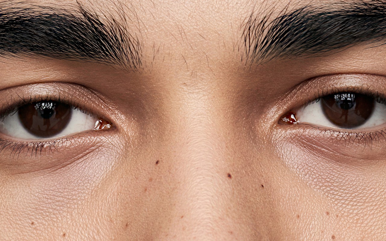 Bridge of the nose, grain scale 2.5 — pores
