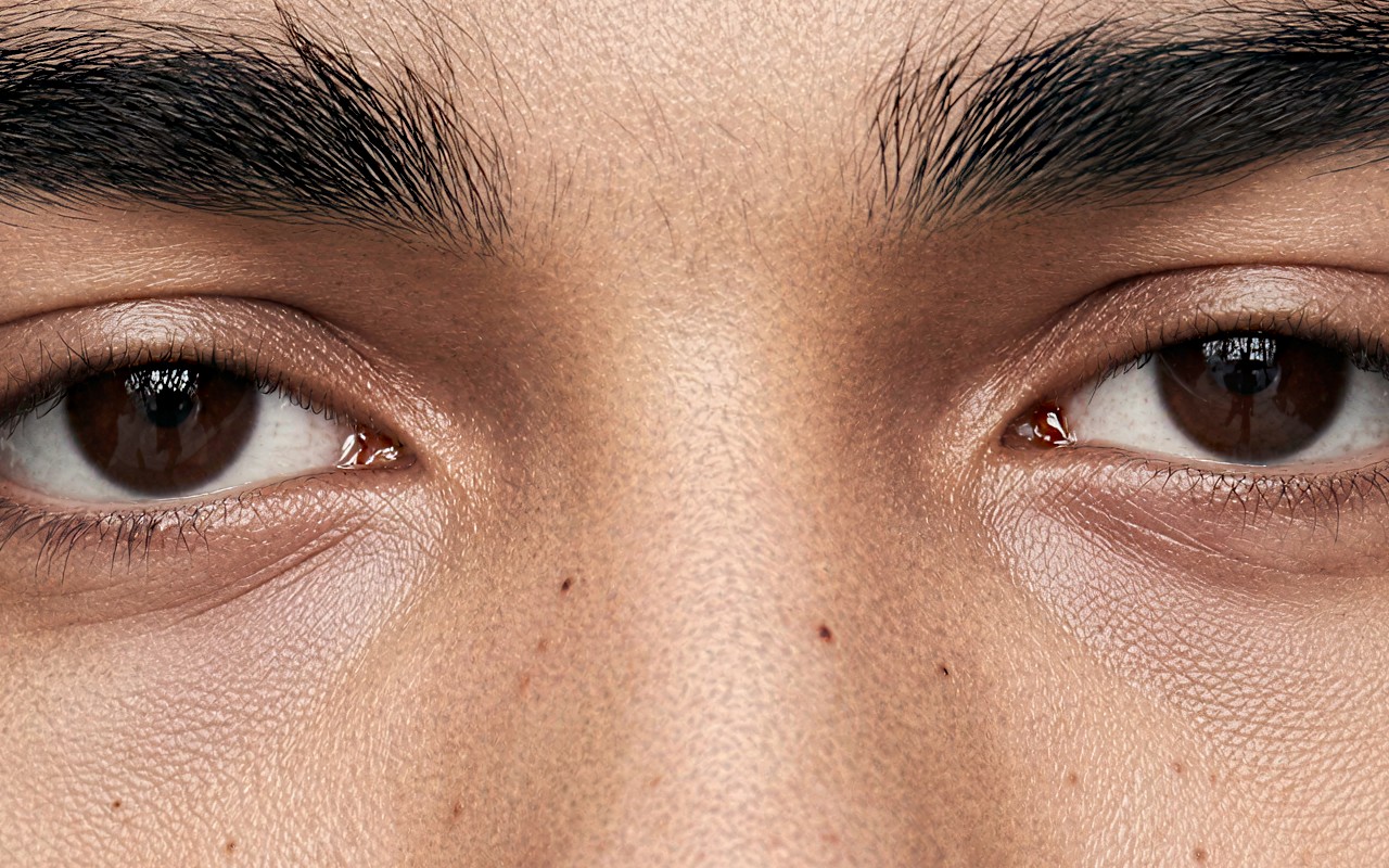 Bridge of the nose, grain scale 3.5 — pores